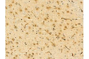 ABIN7094283 and ABIN7098330 at 1/100 staining Mouse brain tissue by IHC-P.