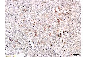 Formalin-fixed and paraffin embedded rat spinal cord labeled with Anti-C-fos Polyclonal Antibody (ABIN669021), Unconjugated at 1:300, followed by conjugation to the secondary antibody and DAB staining (c-FOS antibody  (AA 1-100))