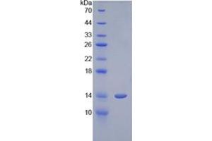 SDS-PAGE analysis of Human Cystatin 1 Protein. (CSTL1 Protein)