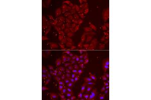Immunofluorescence analysis of U2OS cell using TPP2 antibody. (Tpp2 antibody)