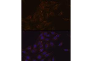 Immunofluorescence analysis of C6 cells using PIST/GOPC Rabbit mAb (ABIN1678809, ABIN1678808, ABIN7101325 and ABIN7101326) at dilution of 1:100 (40x lens). (GOPC antibody)