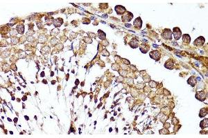 Immunohistochemistry of paraffin-embedded Rat testis using MME Polyclonal Antibody at dilution of 1:100 (40x lens). (MME antibody)