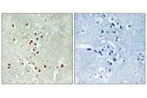 Immunohistochemistry analysis of paraffin-embedded human brain tissue using GADD45GIP1 antibody. (GADD45GIP1 antibody)