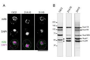 Immunohistochemistry (IHC) image for anti-Nucleoporin 98kDa (NUP98) (GLFG Motif), (N-Term) antibody (ABIN2452064)