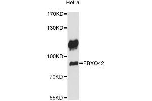 Western blot analysis of extracts of HeLa cells, using FBXO42 antibody (ABIN6292073) at 1:1000 dilution.