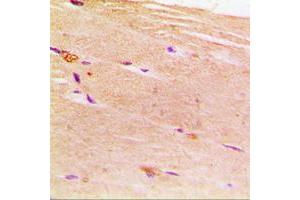 Immunohistochemical analysis of ACTN2 staining in human muscle formalin fixed paraffin embedded tissue section. (ACTN2 antibody  (N-Term))