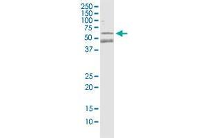 Western Blotting (WB) image for anti-Parkinson Protein 2, E3 Ubiquitin Protein Ligase (Parkin) (PARK2) (AA 288-387) antibody (ABIN562106)