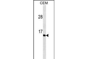 GAST Antibody ABIN1539897 western blot analysis in CEM cell line lysates (35 μg/lane). (Gastrin antibody  (AA 49-78))