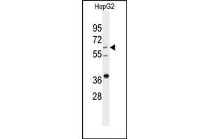 Image no. 1 for anti-24-Dehydrocholesterol Reductase (DHCR24) (Middle Region) antibody (ABIN358015)