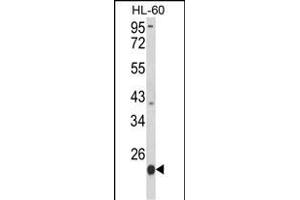 Western blot analysis of PSMB9 Antibody (C-term) (ABIN652496 and ABIN2842334) in HL-60 cell line lysates (35 μg/lane). (PSMB9 antibody  (C-Term))