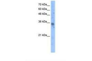 Image no. 1 for anti-Solute Carrier Family 25 (Mitochondrial Carrier, Graves Disease Autoantigen), Member 16 (SLC25A16) (AA 51-100) antibody (ABIN320858) (SLC25A16 antibody  (AA 51-100))