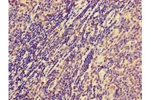 Immunohistochemistry of paraffin-embedded human lymph node tissue using ABIN7161071 at dilution of 1:100 (NCR1 antibody  (AA 121-230))