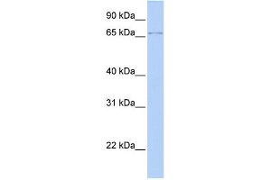 WB Suggested Anti-ZFP64 Antibody Titration:  0.