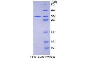 SDS-PAGE (SDS) image for Coagulation Factor III (thromboplastin, Tissue Factor) (F3) (AA 36-292) protein (His tag) (ABIN2126963) (Tissue factor Protein (AA 36-292) (His tag))