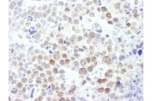 Immunohistochemistry (IHC) image for anti-Enhancer of Zeste Homolog 2 (EZH2) (AA 696-746) antibody (ABIN7450991) (EZH2 antibody  (AA 696-746))