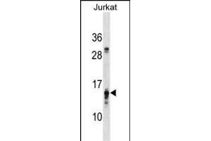 PFDN4 Antibody (N-term) (ABIN1539356 and ABIN2850409) western blot analysis in Jurkat cell line lysates (35 μg/lane).