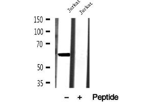 Western blot analysis of extracts of Jurkat cells, using AHCYL1 antibody. (AHCYL1 antibody  (N-Term))