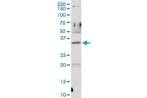PDLIM1 MaxPab rabbit polyclonal antibody. (PDLIM1 antibody  (AA 1-329))