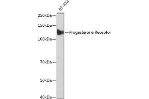 Progesterone Receptor antibody