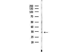 anti-Cathepsin K (CTSK) (N-Term) antibody