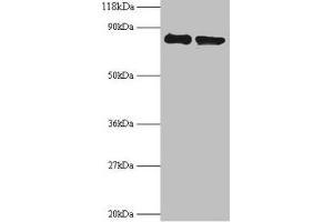 Western blot All lanes: RPS10 antibody at 2 μg/mL Lane 1: EC109 whole cell lysate Lane 2: 293T whole cell lysate Secondary Goat polyclonal to rabbit IgG at 1/15000 dilution Predicted band size: 19 kDa Observed band size: 80 kDa (RPS1 (AA 4-165) antibody)