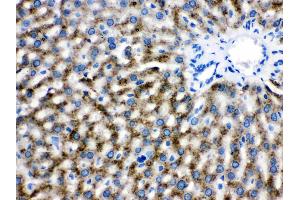 Catalase was detected in paraffin-embedded sections of rat liver tissues using rabbit anti- Catalase Antigen Affinity purified polyclonal antibody (Catalog # ) at 1 µg/mL. (Catalase antibody  (AA 344-527))