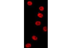 ABIN6277154 staining  HT29 cells by IF/ICC.