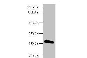 Western blot All lanes: CLDN18 antibody IgG at 3. (Claudin 18 antibody  (AA 20-80))