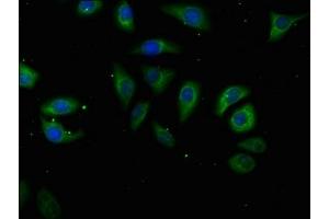 Immunofluorescence staining of A549 cells with ABIN7175225 at 1:50, counter-stained with DAPI. (ATP6V1A antibody  (Catalytic Subunit A))