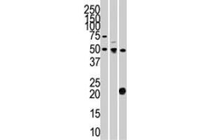 The STYK1 polyclonal antibody  is used in Western blot to detect STYK1 in 293 (left) , CEM (center) , and mouse kidney (right) cell line and tissue lysates.