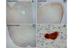 Immunohistochemistry (IHC) image for anti-Amyloid beta (A4) Precursor Protein (APP) antibody (ABIN6655141)