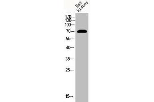 Western Blot analysis of RAT-kidney cells using Acetyl-HSP70 (K246) Polyclonal Antibody (HSP70 1A antibody  (acLys246))