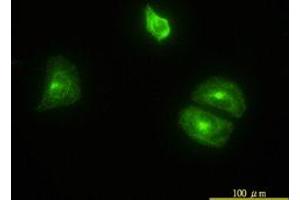 Image no. 4 for anti-Clathrin, Light Chain B (CLTB) (AA 1-212) antibody (ABIN598618) (CLTB antibody  (AA 1-212))
