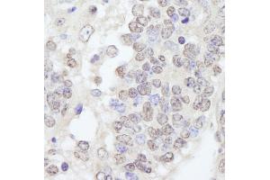 Immunohistochemistry (IHC) image for anti-Tripartite Motif Containing 33 (TRIM33) (C-Term) antibody (ABIN7448843) (TRIM33 antibody  (C-Term))