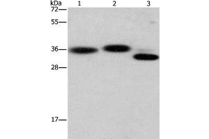 Western Blot analysis of Hela cell, Mouse brain and heart tissue using CAPZA2 Polyclonal Antibody at dilution of 1:650 (CAPZA2 antibody)