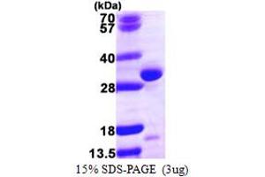 SDS-PAGE (SDS) image for Quinoid Dihydropteridine Reductase (QDPR) (AA 1-244) protein (His tag) (ABIN667949)