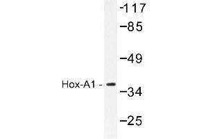 Image no. 1 for anti-Homeobox A1 (HOXA1) antibody (ABIN272197) (HOXA1 antibody)