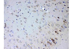 IHC analysis of IL15RA using anti-IL15RA antibody . (IL15RA antibody  (AA 31-174))
