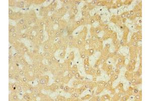 Immunohistochemistry of paraffin-embedded human liver tissue using ABIN7174641 at dilution of 1:100 (UGT2B4 antibody  (AA 281-481))