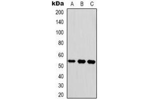 Western blot analysis of Vitronectin expression in HEK293T (A), mouse brain (B), mouse lung (C) whole cell lysates. (Vitronectin antibody)