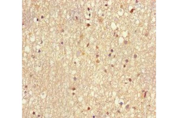 UBE2V2 antibody  (AA 2-145)