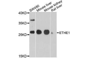 Western blot analysis of extracts of various cell lines, using ETHE1 antibody. (ETHE1 antibody  (AA 8-245))