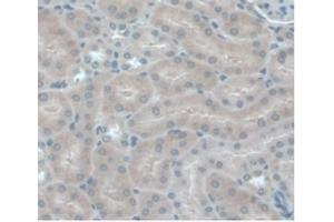 IHC-P analysis of Mouse Kidney Tissue, with DAB staining. (CCL2 antibody  (AA 24-96))