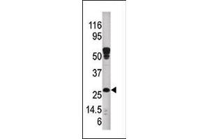 Western blot analysis of anti-ABAD Pab (ABIN390286 and ABIN2850545) in mouse kidney tissue lysate. (HSD17B10 antibody  (C-Term))