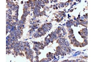 IHC analysis of Neurofibromin/NF1 using anti-Neurofibromin/NF1 antibody (ABIN7600196). (Neurofibromin 1 antibody  (AA 160-270))