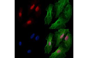 ABIN6261092 and ABIN6277988 staining  cells by IF/ICC.