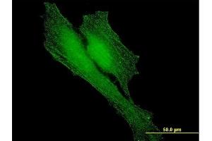 Immunofluorescence of monoclonal antibody to BARD1 on HeLa cell. (BARD1 antibody  (AA 658-757))