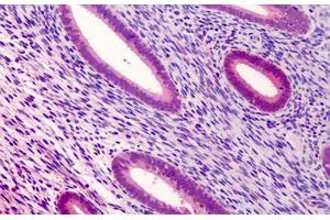 Human Uterus: Formalin-Fixed, Paraffin-Embedded (FFPE) (ATG16L1 antibody  (Internal Region))