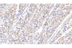 Detection of TNS1 in Human Stomach Tissue using Polyclonal Antibody to Tensin 1 (TNS1) (Tensin 1 antibody  (AA 4-307))