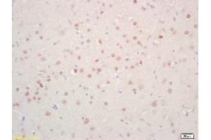 Formalin-fixed and paraffin embedded rat brain labeled with Rabbit Anti Phosphoserine/threonine/tyrosine Polyclonal Antibody, Unconjugated (ABIN1385069) at 1:200 followed by conjugation to the secondary antibody and DAB staining (Phosphoserine/Phosphothreonine/Phosphotyrosine (phosphorylated) antibody)